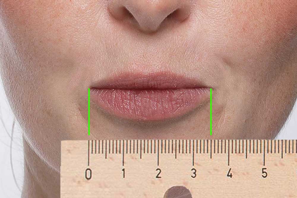 Labiando-Lippentrainer-Vermessung-Manuell